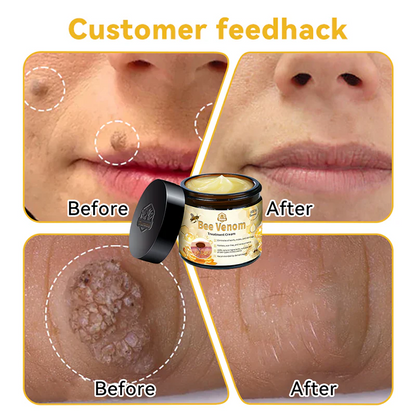 👩‍⚕️🐝 Turonu™ Bee Venom Skin Therapy Cream |✅ Endorsed by Canadian Dermatologists