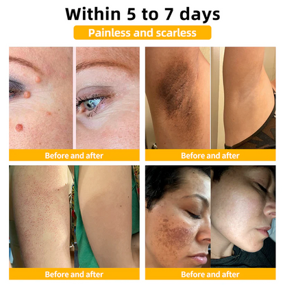 👩‍⚕️🐝 Turonu™ Bee Venom Skin Therapy Cream |✅ Endorsed by Canadian Dermatologists