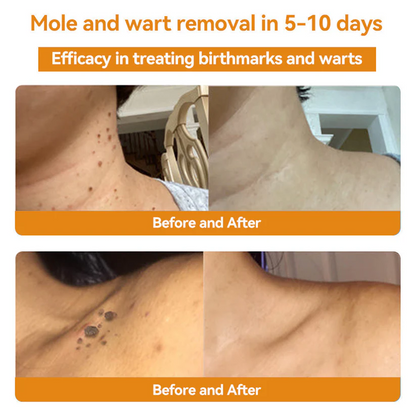 👩‍⚕️🐝 Turonu™ Bee Venom Skin Therapy Cream |✅ Endorsed by Canadian Dermatologists
