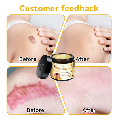 👩‍⚕️🐝 Turonu™ Bee Venom Skin Therapy Cream |✅ Endorsed by Canadian Dermatologists